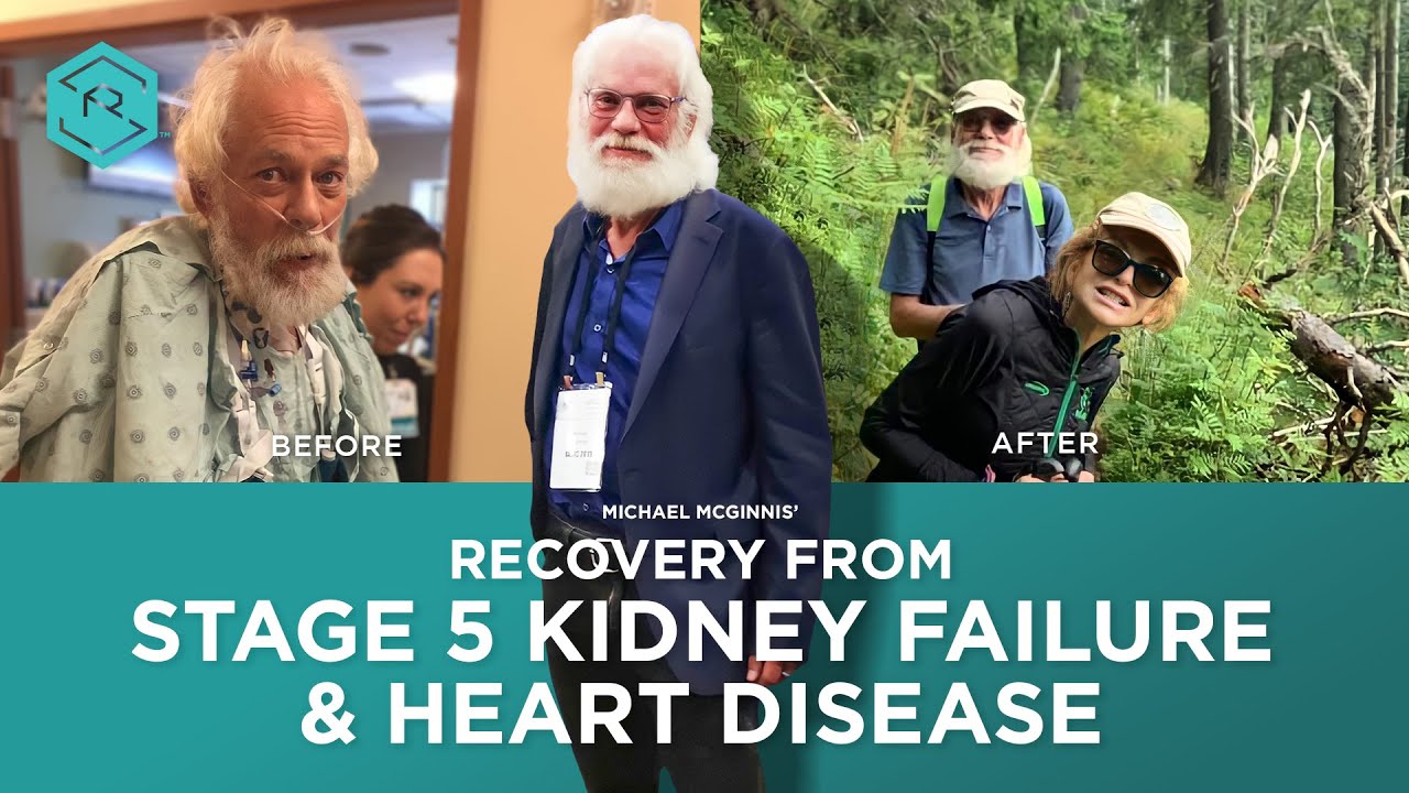 Kidney donation  